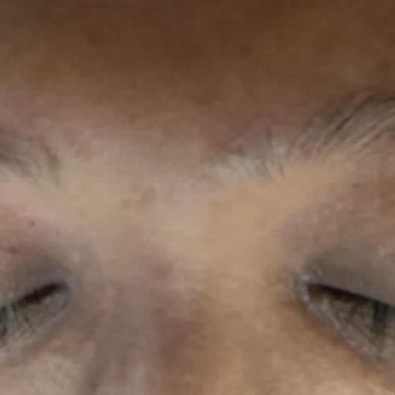 Eyebrow Transformation Before