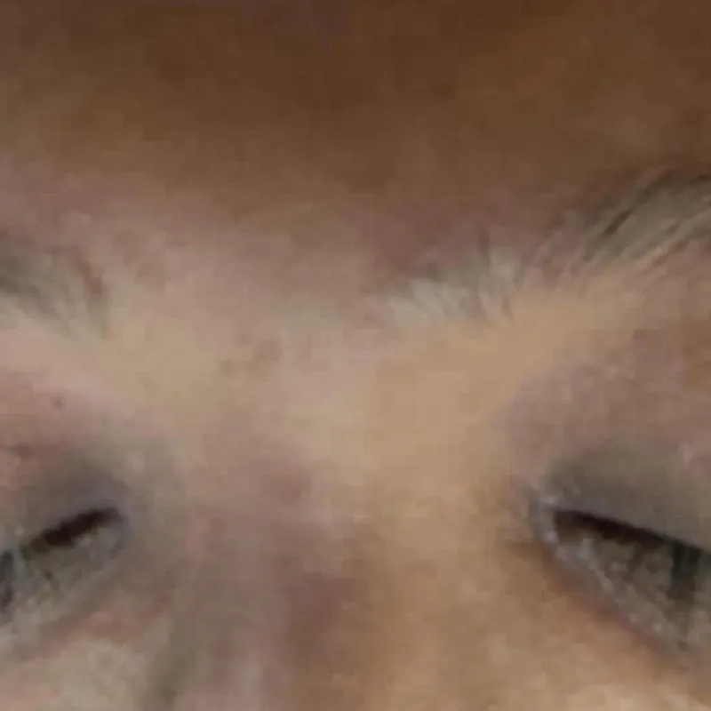 Eyebrow Before